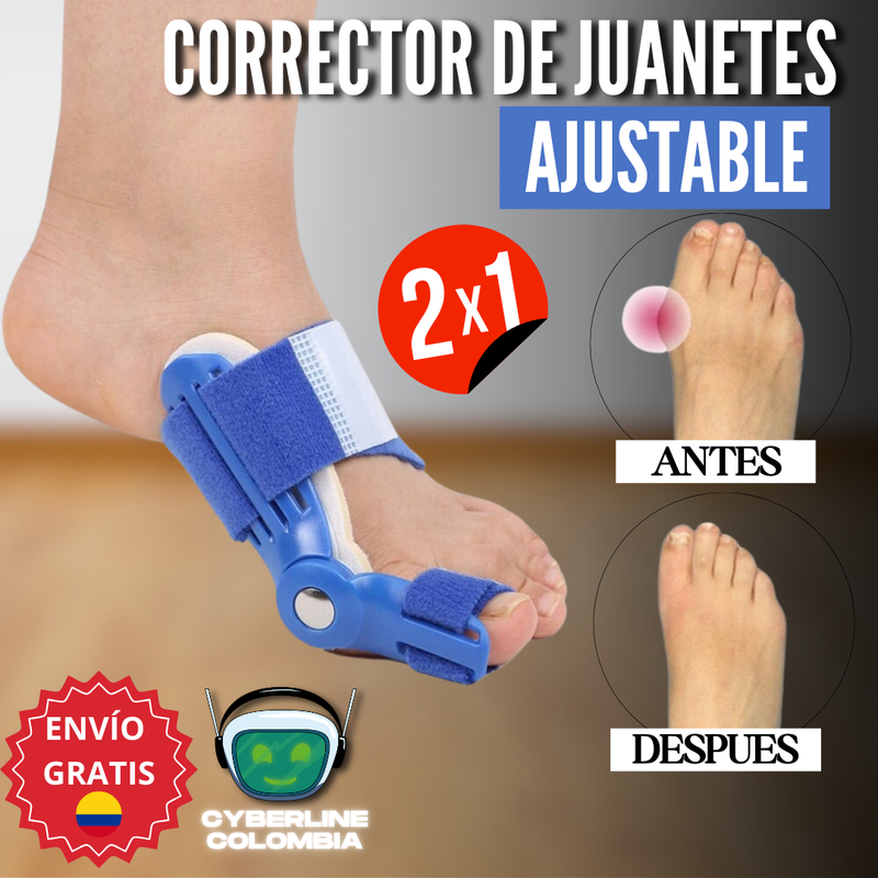 Corrector de Juanetes 2X1 - ¡Recupera la salud de tus pies en solo días!